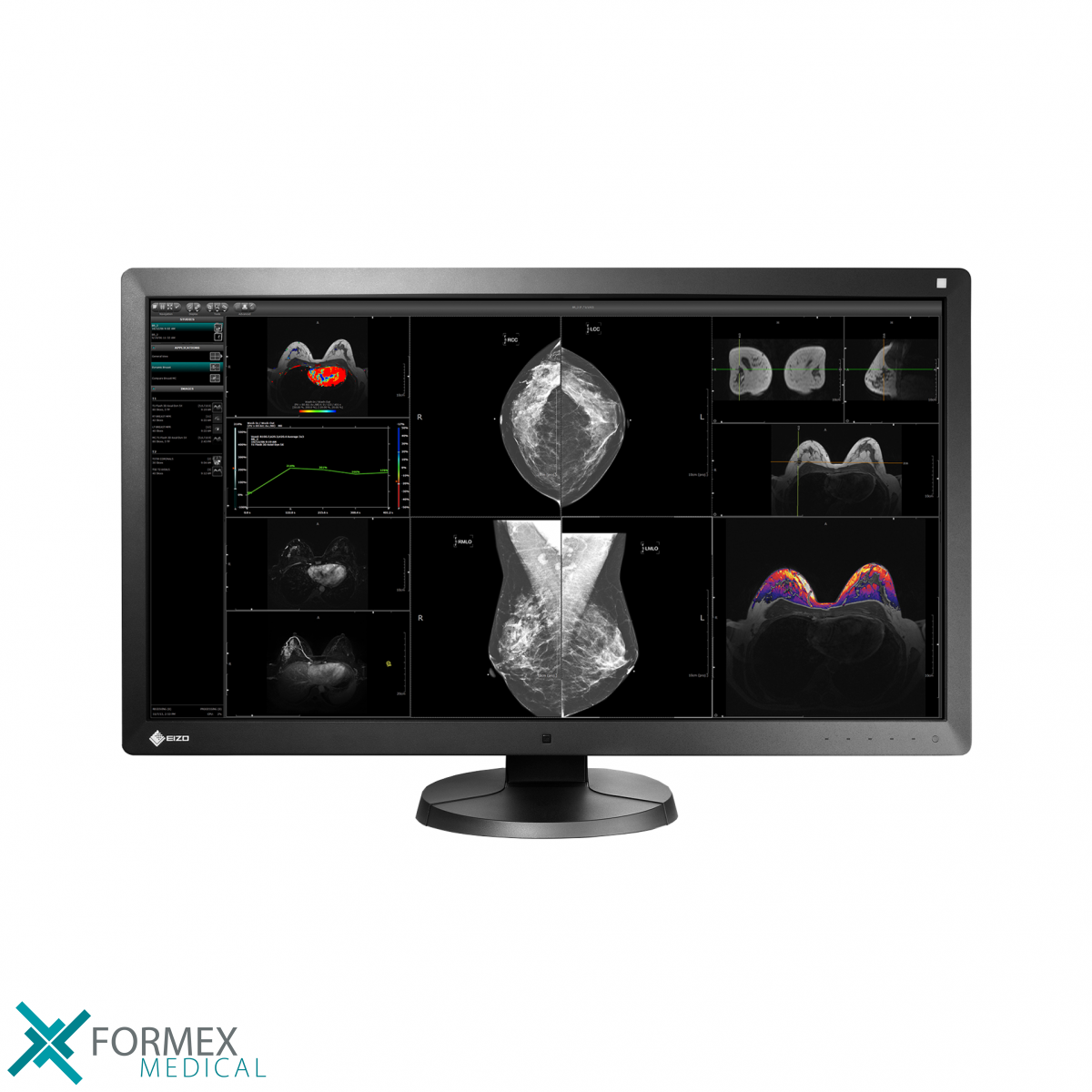EIZO RX370 RadiForce, medical displays, medische schermen, eizo medical monitor, medische monitoren, eizo medical, medische beeldschermen, diagnostische monitoren, diagnostiek monitoren, eizo monitor