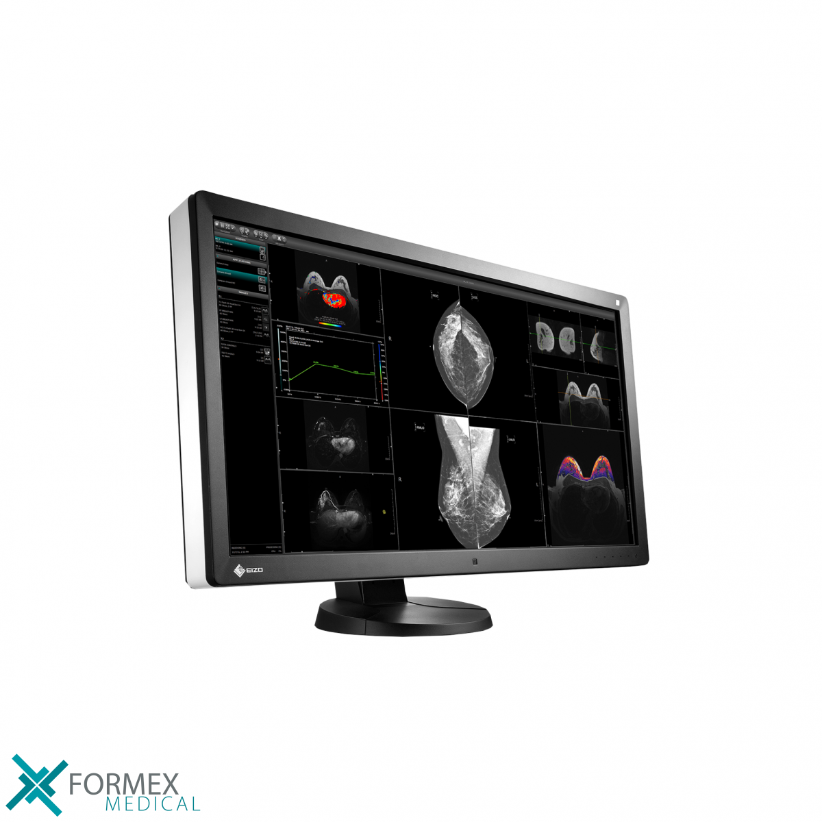 EIZO RX370 RadiForce, medical displays, medische schermen, eizo medical monitor, medische monitoren, eizo medical, medische beeldschermen, diagnostische monitoren, diagnostiek monitoren, eizo monitor