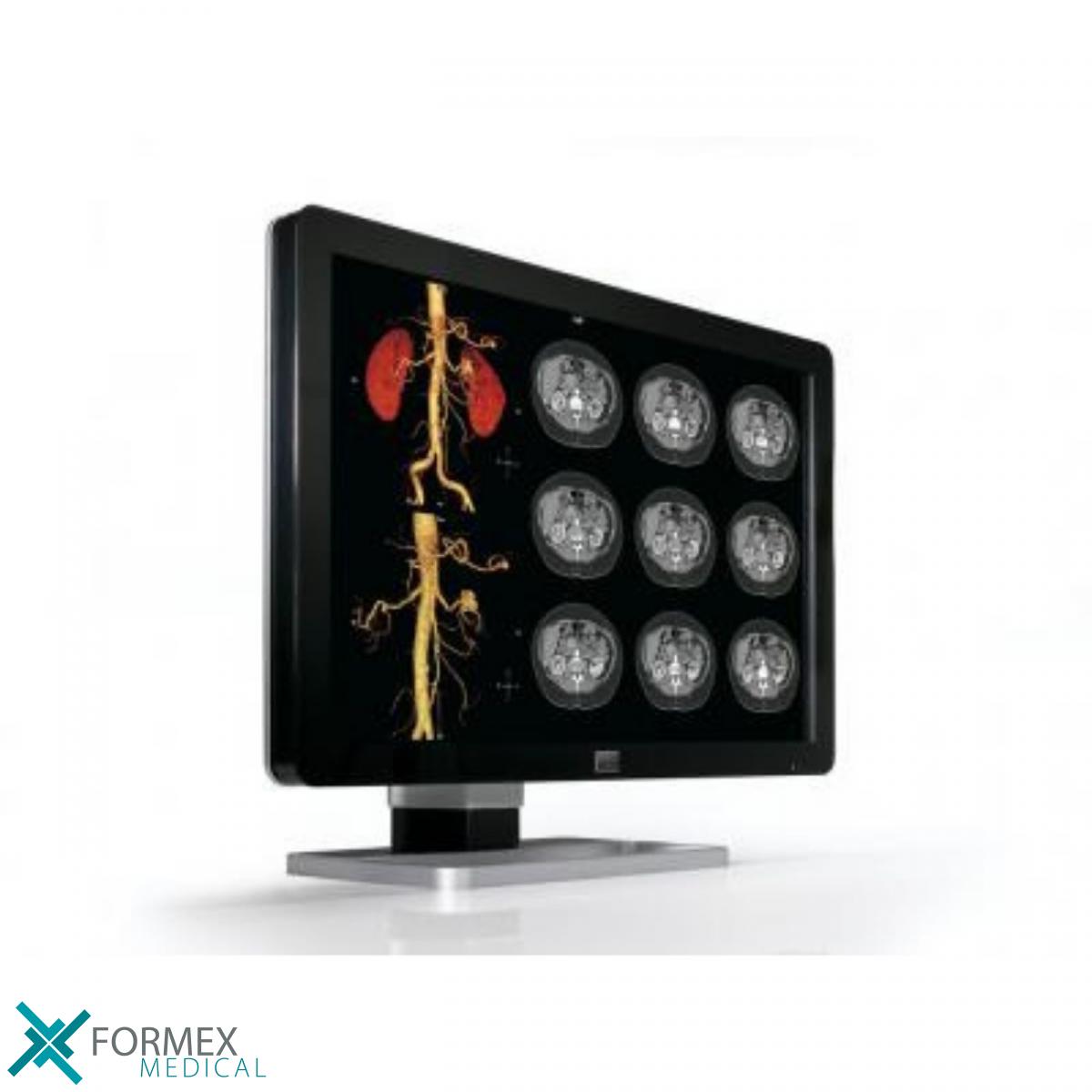 Barco Coronis Fusion 4MP (MDCC-4430), medical displays, medische schermen, eizo medical monitor, medische monitoren, eizo medical, medische beeldschermen, diagnostische monitoren, diagnostiek monitoren, eizo monitor