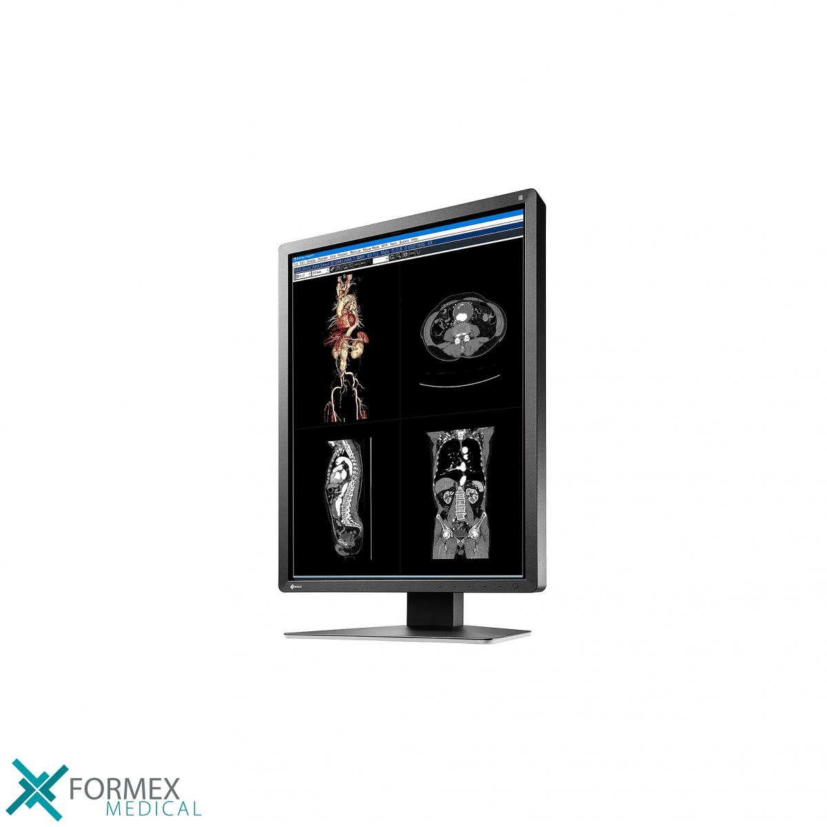 Eizo MX216-SB RadiForce, eizo monitor, medical displays, medische schermen, eizo medical monitor, medische monitoren, eizo medical, medische beeldschermen, diagnostische monitoren, diagnostiek monitoren