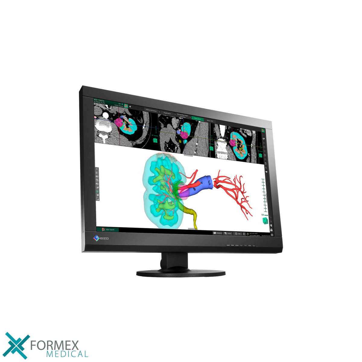 Eizo MX242W RadiForce, eizo monitor, medical displays, medische schermen, eizo medical monitor, medische monitoren, eizo medical, medische beeldschermen, diagnostische monitoren, diagnostiek monitoren