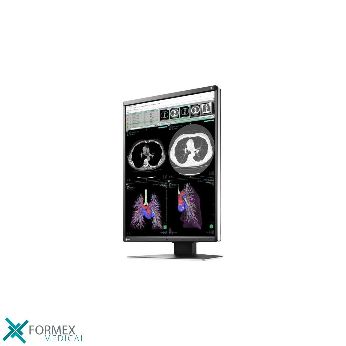 Eizo RX360 RadiForce, medical displays, medische schermen, eizo medical monitor, medische monitoren, eizo medical, medische beeldschermen, diagnostische monitoren, diagnostiek monitoren, eizo monitor