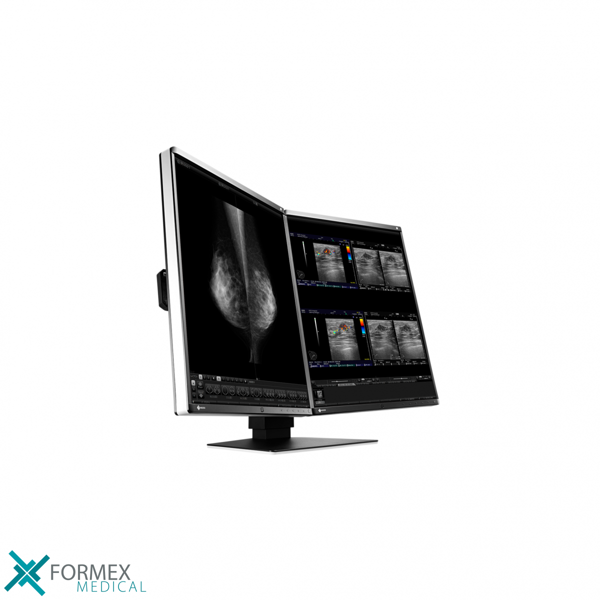 Eizo RX560-MD RadiForce, eizo monitor, medical displays, medische schermen, eizo medical monitor, medische monitoren, eizo medical, medische beeldschermen, diagnostische monitoren, diagnostiek monitoren