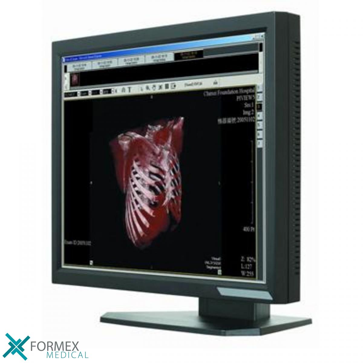 medische monitoren, medische displays, medische beeldschermen, monitoroplossingen, diagnostische monitoren