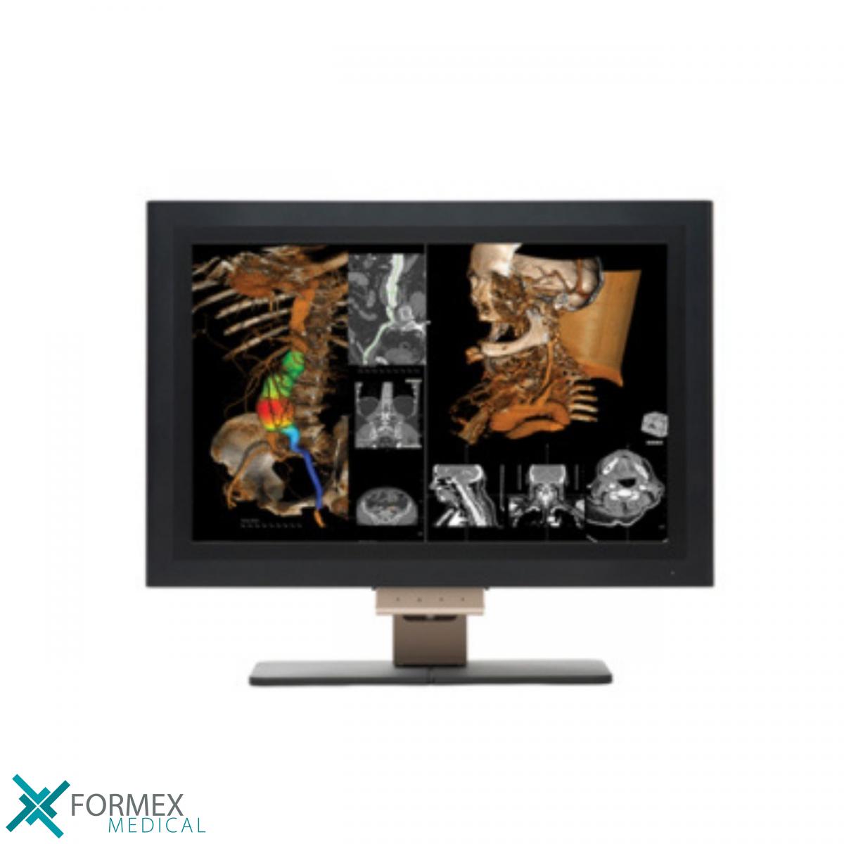 röntgenfoto, MRI, CT-scan, CAT-scan, digitale radiologie, echografie, angiografie, medische beeldvorming, radiografie, hartkath, draagbare röntgenfoto