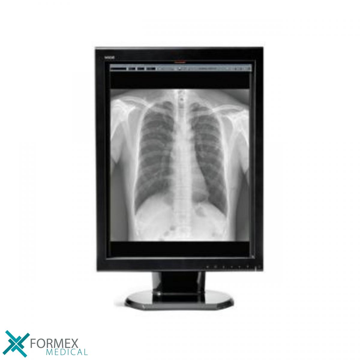 Wide MX30, medical displays, medische schermen, eizo medical monitor, medische monitoren, eizo medical, medische beeldschermen, diagnostische monitoren, diagnostiek monitoren, eizo monitor