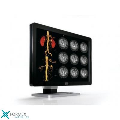 Barco Coronis Fusion 4MP (MDCC-4430), medical displays, medische schermen, eizo medical monitor, medische monitoren, eizo medical, medische beeldschermen, diagnostische monitoren, diagnostiek monitoren, eizo monitor