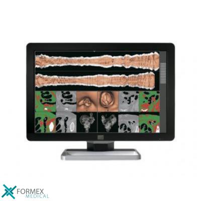 Barco Coronis Fusion 6MP LED, MDCC-6530, medical displays, medische schermen, eizo medical monitor, medische monitoren, eizo medical, medische beeldschermen, diagnostische monitoren, diagnostiek monitoren, eizo monitor