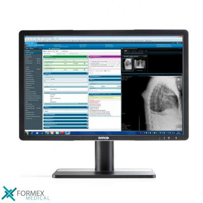 barco Eonis 22, medical displays, medische schermen, eizo medical monitor, medische monitoren, eizo medical, medische beeldschermen, diagnostische monitoren, diagnostiek monitoren, eizo monitor