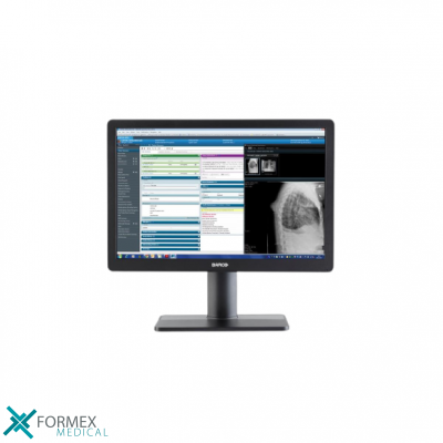 Barco Eonis 24 inch (MDRC-2324), medical displays, medische schermen, eizo medical monitor, medische monitoren, eizo medical, medische beeldschermen, diagnostische monitoren, diagnostiek monitoren, eizo monitor