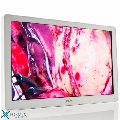 Barco MDSC-2232, medical displays, medische schermen, eizo medical monitor, medische monitoren, eizo medical, medische beeldschermen, diagnostische monitoren, diagnostiek monitoren, eizo monitor