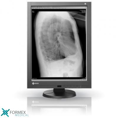 Eizo RadiForce GX240, medical displays, medische schermen, eizo medical monitor, medische monitoren, eizo medical, medische beeldschermen, diagnostische monitoren, diagnostiek monitoren, eizo monitor