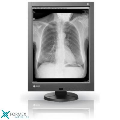 Eizo RadiForce GX340, medical displays, medische schermen, eizo medical monitor, medische monitoren, eizo medical, medische beeldschermen, diagnostische monitoren, diagnostiek monitoren, eizo monitor