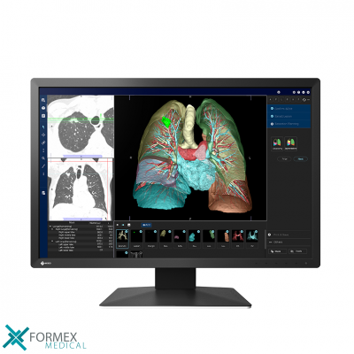 Eizo RadiForce MX243W 