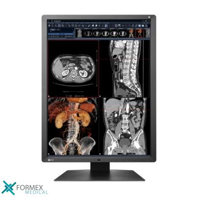 Eizo RadiForce RX250, teleradiologie, medical displays, medische schermen, eizo medical monitor, medische monitoren, eizo medical, medische beeldschermen, diagnostische monitoren, diagnostiek monitoren, eizo monitor