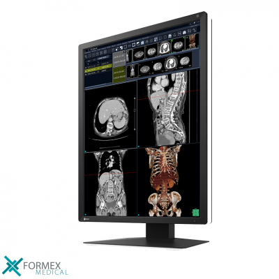Eizo, RX270, DICOM, diagnostisch, medisch scherm, radiologie monitor, diagnostiek monitor, radiologie scherm