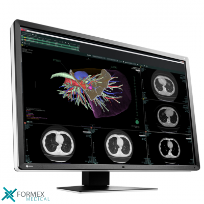 eizo monitor, medical displays, medische schermen, eizo medical monitor, medische monitoren, eizo medical, medische beeldschermen, diagnostische monitoren, diagnostiek monitoren