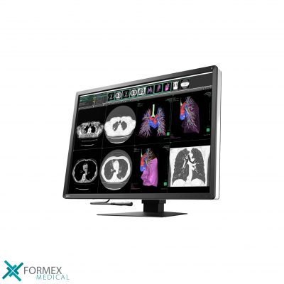 Eizo RadiForce RX1270, eizo monitor, medical displays, medische schermen, eizo medical monitor, medische monitoren, eizo medical, medische beeldschermen, diagnostische monitoren, diagnostiek monitoren 