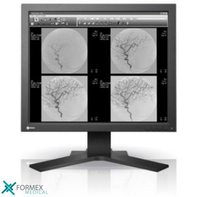 Eizo SMD 19102, medical displays, medische schermen, eizo medical monitor, medische monitoren, eizo medical, medische beeldschermen, diagnostische monitoren, diagnostiek monitoren, eizo monitor