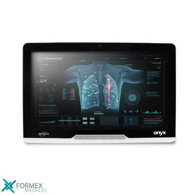 Onyx MATE2-2210, medical displays, medische schermen, eizo medical monitor, medische monitoren, eizo medical, medische beeldschermen, diagnostische monitoren, diagnostiek monitoren, eizo monitor