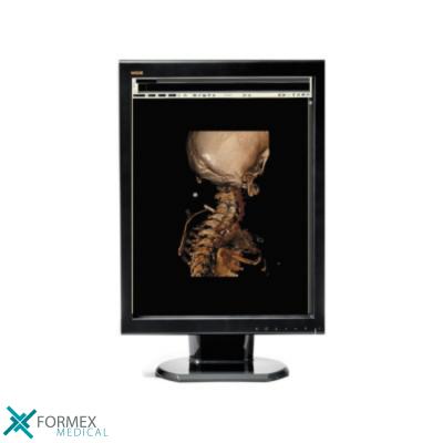 röntgenfoto, MRI, CT-scan, CAT-scan, digitale radiologie, echografie, angiografie, medische beeldvorming, radiografie, hartkath, draagbare röntgenfoto, medical displays, medische schermen, medische monitoren