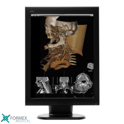 röntgenfoto, MRI, CT-scan, CAT-scan, digitale radiologie, echografie, angiografie, medische beeldvorming, radiografie, hartkath, draagbare röntgenfoto, medical displays, medische schermen, medische monitoren