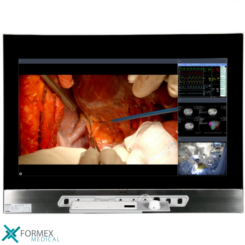Barco MDMX-25500 GNNB, medical displays, medische schermen, eizo medical monitor, medische monitoren, eizo medical, medische beeldschermen, diagnostische monitoren, diagnostiek monitoren, eizo monitor