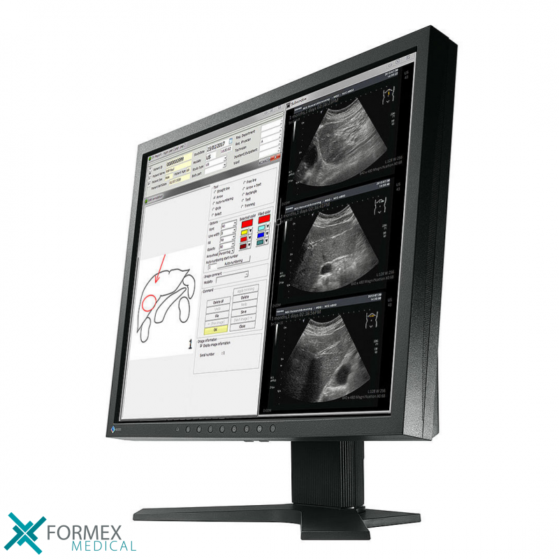 Eizo MX194 RadiForce, medical displays, medische schermen, eizo medical monitor, medische monitoren, eizo medical, medische beeldschermen, diagnostische monitoren, diagnostiek monitoren, eizo monitor